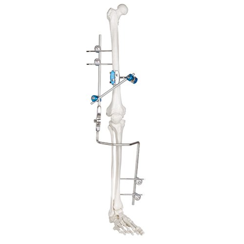orthopedic-_0005s_0003_7100-18