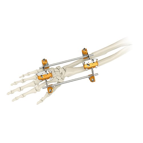 orthopedic-_0005s_0021_7100-03