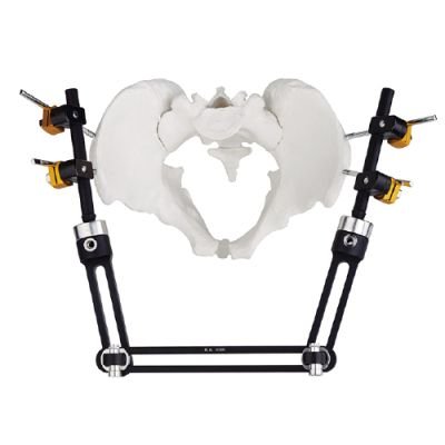 Pelvic Fragment External Fixator – Type C