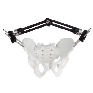 Pelvic Fragment External Fixator - Type B