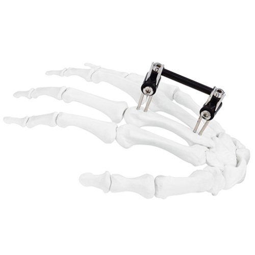 orthopedic-_0007s_0024_6100-0105