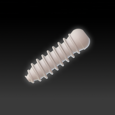 Bioabsorbable PLGA Interference Screw